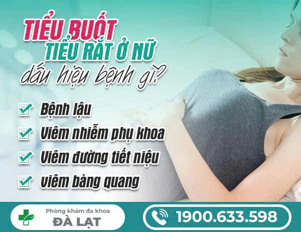 Hình ảnh minh họa